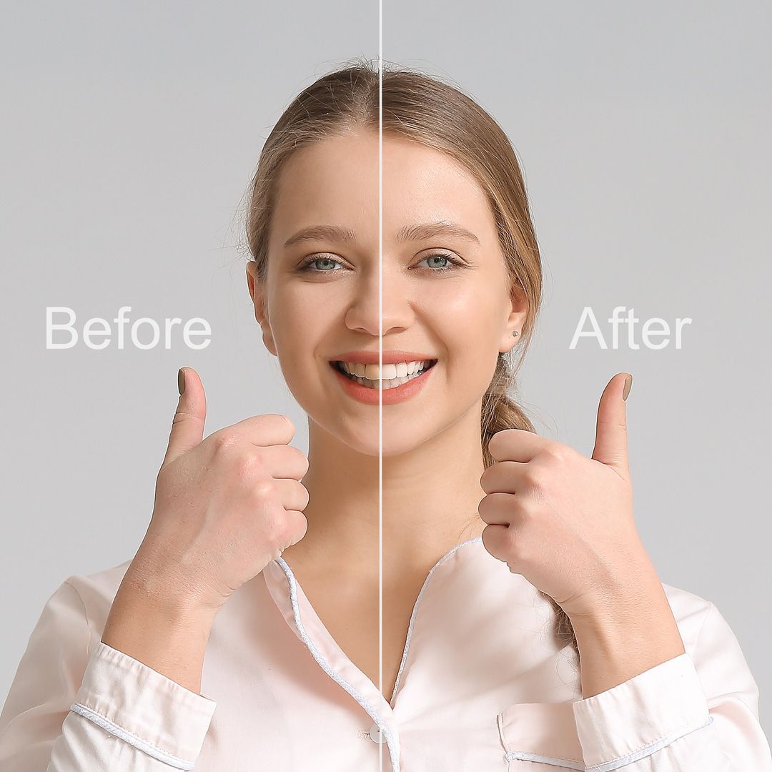 smile makeover hero