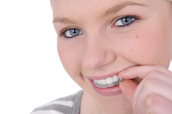 teen braces