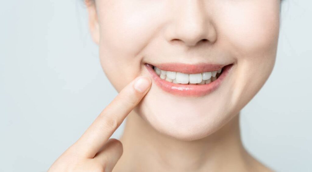 Teeth after dental bonding and white fillings.