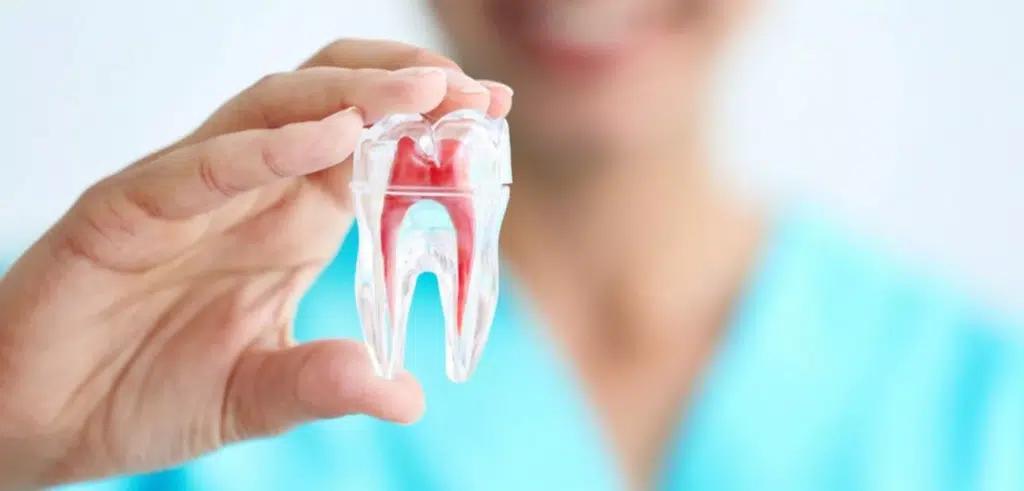 An impacted wisdom teeth extraction specialist showing a plastic tooth model.