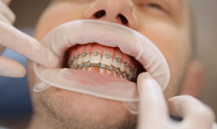 ortho 1